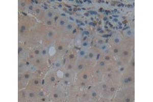 Used in DAB staining on fromalin fixed paraffin- embedded Kidney tissue