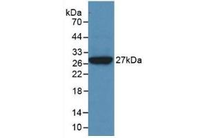 Detection of Recombinant CLU, Human using Monoclonal Antibody to Clusterin (CLU) (Clusterin anticorps  (AA 228-449))