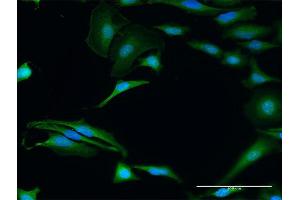 Immunofluorescence of purified MaxPab antibody to FXR2 on HeLa cell. (FXR2 anticorps  (AA 1-673))