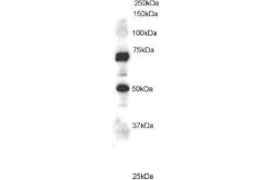 Western Blotting (WB) image for anti-Engulfment and Cell Motility 1 (ELMO1) (C-Term) antibody (ABIN2465646) (ELMO1 anticorps  (C-Term))