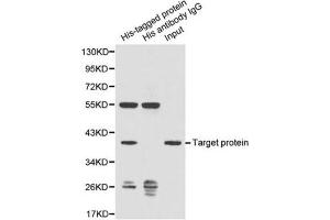 Image no. 1 for anti-His Tag antibody (ABIN2970881) (His Tag anticorps)