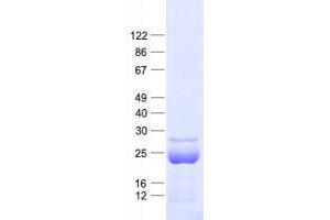 Validation with Western Blot (HMGB2 Protein (His tag))