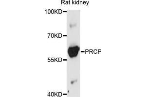 Western blot analysis of extracts of rat kidney, using PRCP antibody (ABIN5972205) at 1/1000 dilution. (PRCP anticorps)