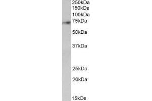 ABIN1590085 (2µg/ml) staining of Human Cerebellum lysate (35µg protein in RIPA buffer). (SYVN1 anticorps  (Internal Region))