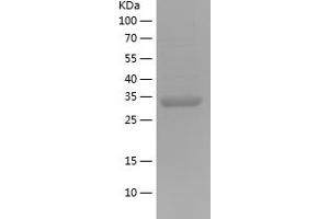 Western Blotting (WB) image for Galactosidase, alpha (GLA) (AA 322-409) protein (His-IF2DI Tag) (ABIN7123037)