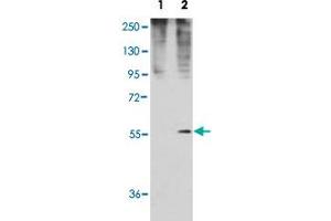 Western blot analysis of GDF11 (arrow) using rabbit GDF11 polyclonal antibody . (GDF11 anticorps  (N-Term))