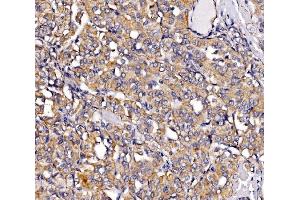 IHC analysis of MIRO1/RHOT1 using anti-MIRO1/RHOT1 antibody (ABIN7602209).