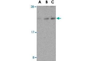Western blot analysis of DAD1 in HepG2 cell lysate with DAD1 polyclonal antibody  at (A) 0. (DAD1 anticorps  (C-Term))