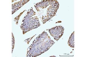 IHC analysis of GIT1 using anti-GIT1 antibody (ABIN7601683). (GIT1 anticorps  (AA 415-736))