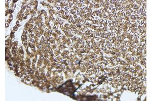 ABIN6274051 at 1/100 staining Mouse liver tissue by IHC-P. (TLR9 anticorps  (Internal Region))