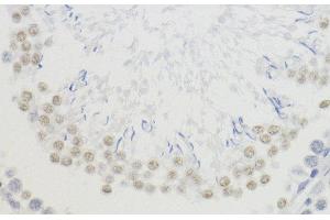 Immunohistochemistry of paraffin-embedded Rat testis using TriMethyl-Histone H4-K20 Polyclonal Antibody at dilution of 1:200 (40x lens).