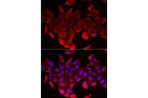 Immunofluorescence analysis of HeLa cell using SLC23A2 antibody. (SLC23A2 anticorps)