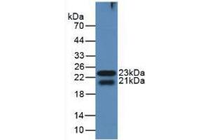 Western blot analysis of the recombinant protein. (LGALS8 anticorps  (AA 151-316))