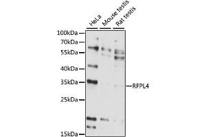 Western blot analysis of extracts of various cell lines, using RFPL4 antibody (ABIN7269924) at 1:1000 dilution. (RFPL4A anticorps  (AA 1-100))