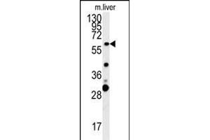 ZCCHC5 Antibody (N-term) (ABIN654002 and ABIN2843937) western blot analysis in mouse liver tissue lysates (15 μg/lane). (ZCCHC5 anticorps  (N-Term))