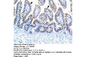 Human Intestine (TRIM15 anticorps  (N-Term))