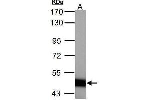 WB Image ABAT antibody detects ABAT protein by Western blot analysis.