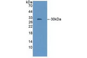 Detection of Recombinant NOS1AP, Mouse using Polyclonal Antibody to Nitric Oxide Synthase 1 Adaptor Protein (NOS1AP) (NOS1AP anticorps  (AA 19-251))