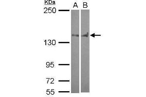 WB Image Sample (30 ug of whole cell lysate) A: A549 B: HCT116 5% SDS PAGE antibody diluted at 1:1000 (PTPN14 anticorps  (C-Term))