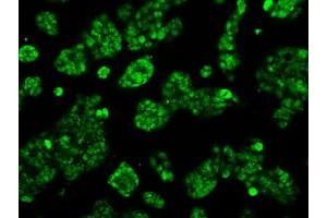 Image no. 1 for anti-Aconitase 2, Mitochondrial (ACO2) antibody (ABIN1496412) (ACO2 anticorps)