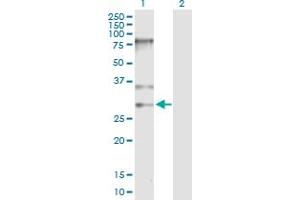 Western Blot analysis of SNRPB expression in transfected 293T cell line by SNRPB MaxPab polyclonal antibody. (SNRPB anticorps  (AA 1-240))