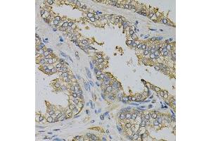 Immunohistochemistry of paraffin-embedded human prostate using EIF4B Antibody. (EIF4B anticorps)