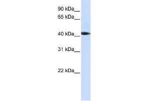WB Suggested Anti-STK17A Antibody Titration:  0. (STK17A anticorps  (C-Term))