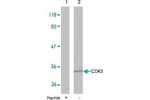 Western blot analysis of extracts from A2780 cells using CDK2 polyclonal antibody  . (CDK2 anticorps)