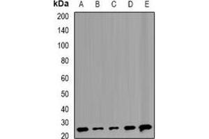 Western blot analysis of TMP21 expression in Raji (A), Hela (B), MCF7 (C), mouse liver (D), rat lung (E) whole cell lysates. (TMED10 anticorps)