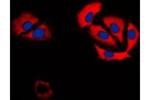 Immunofluorescent analysis of Carbonic Anhydrase 6 staining in H9C2 cells.