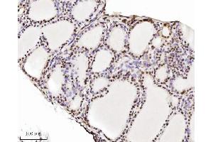 IHC analysis of TRIM24 using anti-TRIM24 antibody (ABIN7602358). (TRIM24 anticorps  (AA 706-964))
