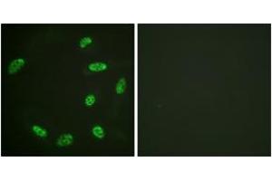 Immunofluorescence analysis of HeLa cells, using ERF (Ab-526) Antibody.