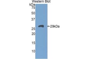 Western blot analysis of the recombinant protein. (TNNT1 anticorps  (AA 1-228))