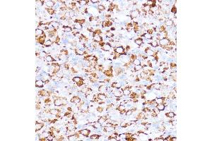 Immunohistochemistry of paraffin-embedded rat ovary using  antibody (ABIN6131164, ABIN6136413, ABIN6136415 and ABIN6217209) at dilution of 1:100 (40x lens).