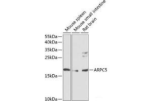 Western blot analysis of extracts of various cell lines using ARPC5 Polyclonal Antibody at dilution of 1:1000. (ARPC5 anticorps)
