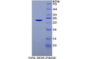 SDS-PAGE analysis of Rat DISC1 Protein. (DISC1 Protéine)