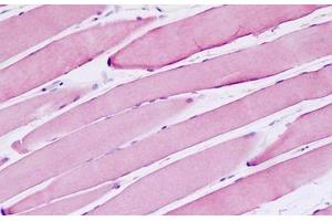 Human Skeletal Muscle: Formalin-Fixed, Paraffin-Embedded (FFPE) (MSH3 anticorps  (AA 51-100))