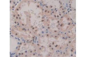 Used in DAB staining on fromalin fixed paraffin- embedded Kidney tissue