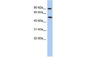PRMT7 antibody used at 1 ug/ml to detect target protein. (PRMT7 anticorps  (N-Term))