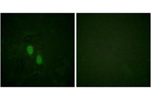 Immunofluorescence analysis of HeLa cells, using hnRPD Antibody . (HNRNPD/AUF1 anticorps)