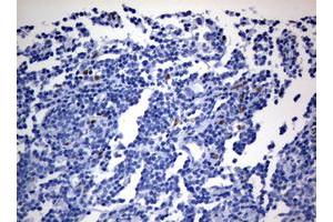 Image no. 1 for anti-Zinc Finger E-Box Binding Homeobox 2 (ZEB2) (AA 1-350) antibody (ABIN1490760)