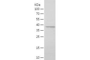 Western Blotting (WB) image for Tafazzin (TAZ) (AA 135-292) protein (His-IF2DI Tag) (ABIN7125314) (TAZ Protein (AA 135-292) (His-IF2DI Tag))