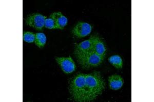 IF analysis of CPT1A using anti-CPT1A antibody (ABIN7599853). (CPT1A anticorps  (AA 122-556))
