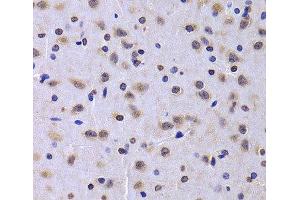 Immunohistochemistry of paraffin-embedded Rat brain using NUDC Polyclonal Antibody at dilution of 1:100 (40x lens). (NUDC anticorps)