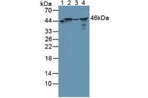 Figure. (BCKDK anticorps  (AA 44-223))
