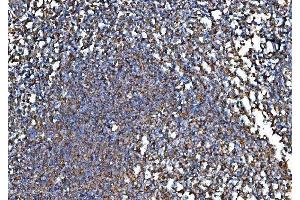 IHC analysis of RPL32 using anti-RPL32 antibody (ABIN7601826). (RPL32 anticorps  (AA 48-129))