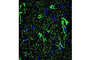 Confocal immunofluorescent analysis of GF Antibody (ABIN659067 and ABIN2838068) with brain tissue followed by Alexa Fluor® 488-conjugated goat anti-mouse lgG (green). (GFAP anticorps)