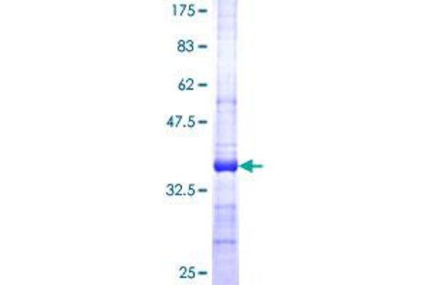 SERPINB9 Protein (AA 279-375) (GST tag)