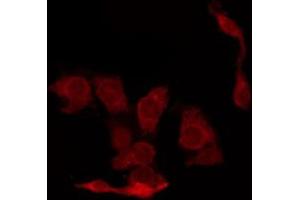 ABIN6267448 staining A2780 by IF/ICC.