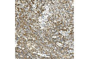IHC analysis of VPS4A using anti-VPS4A antibody (ABIN7599531). (VPS4A anticorps  (AA 1-71))